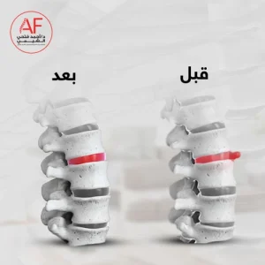 الفقرات العنقية بالصور