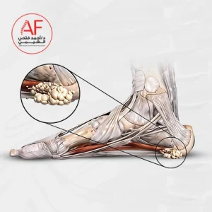 شكل الشوكة العظمية