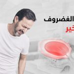 علاج الغضروف بالتبخير