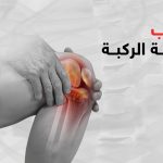 اسباب خشونة الركبة