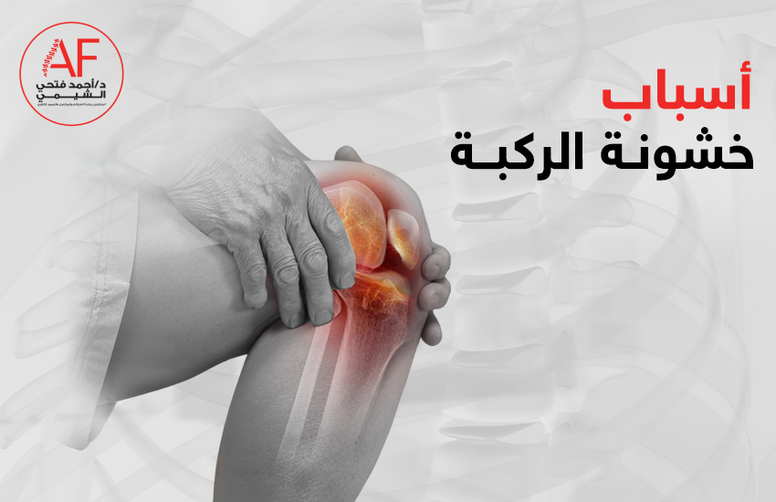 اسباب خشونة الركبة