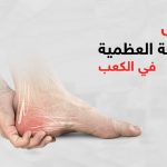 اعراض الشوكة العظمية في الكعب