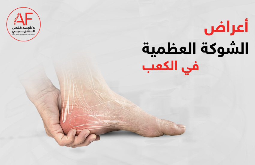 اعراض الشوكة العظمية في الكعب