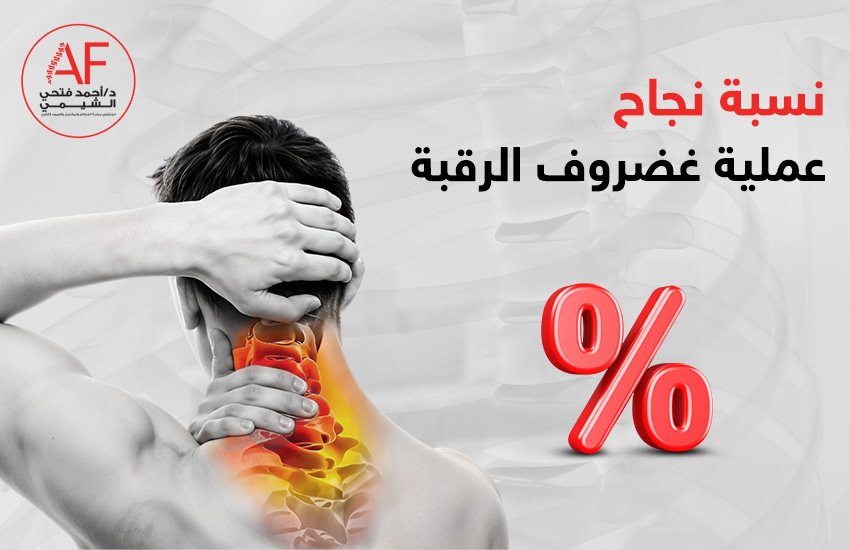 نسبة نجاح عملية غضروف الرقبة