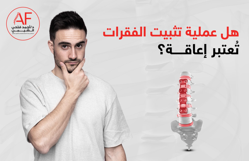 هل عملية تثبيت الفقرات تُعتبر إعاقة؟
