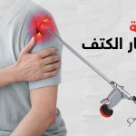 عملية منظار الكتف