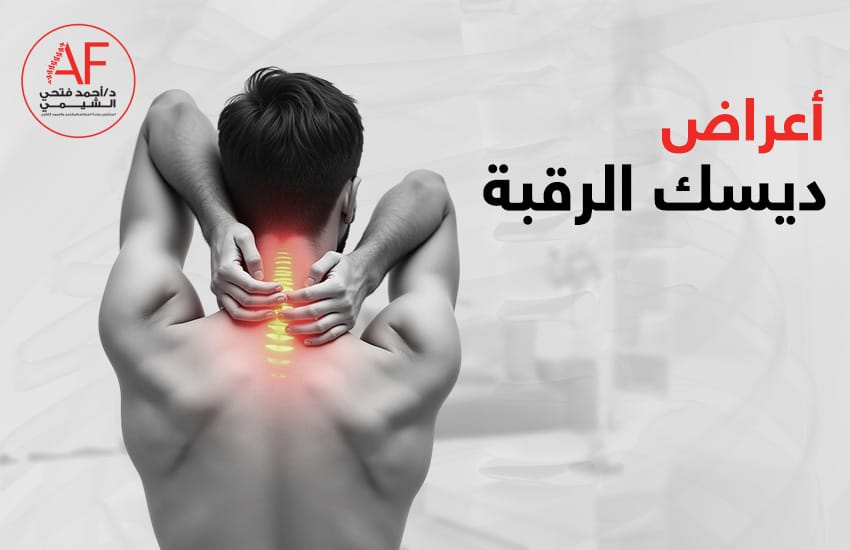 أعراض ديسك الرقبة