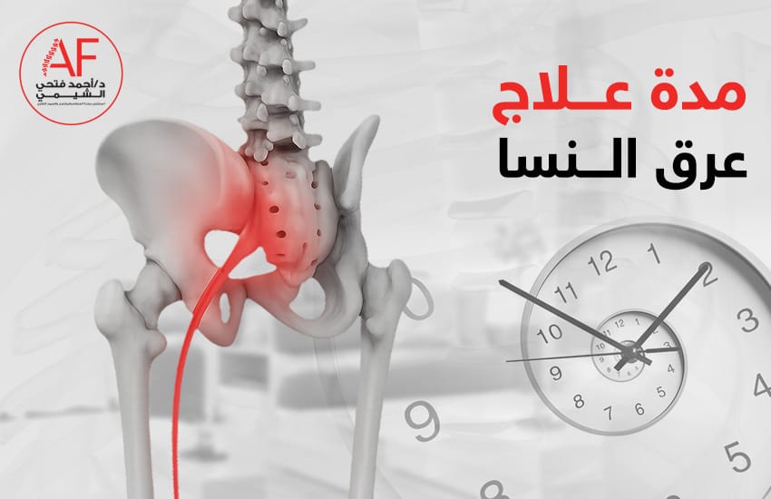 مدة علاج عرق النسا
