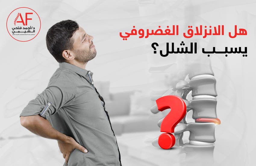 هل الانزلاق الغضروفي يسبب الشلل؟