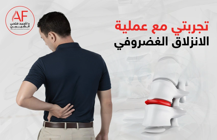 تجربتي مع عملية الانزلاق الغضروفي