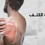 تمزق اربطة الكتف
