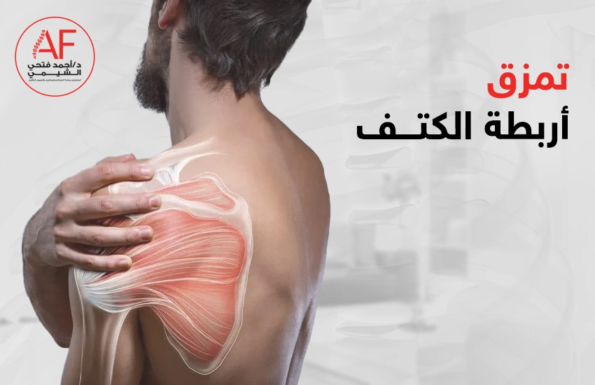 تمزق اربطة الكتف