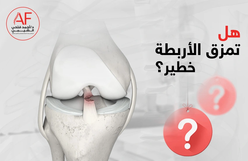 هل تمزق الاربطة خطير