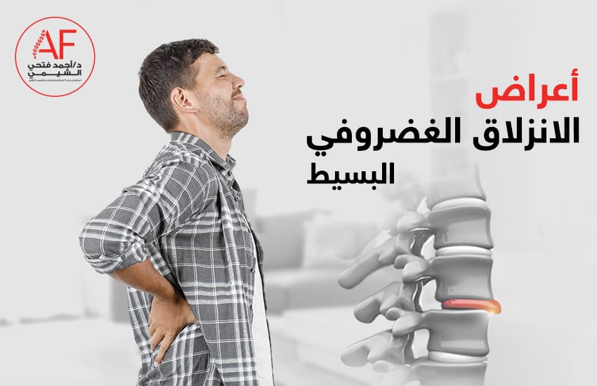 أعراض-الانزلاق-الغضروفي-البسيط