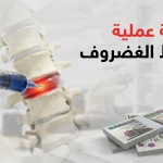 تكلفة عملية شفط الغضروف