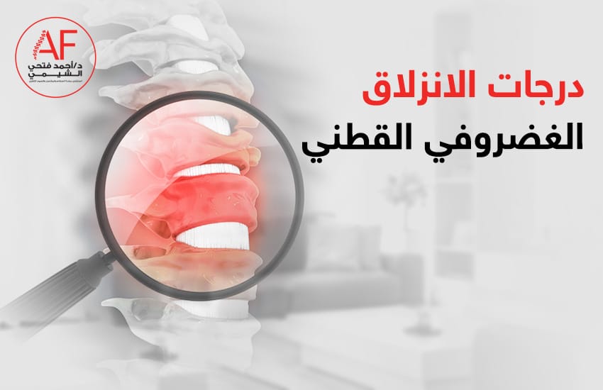 درجات-الانزلاق-الغضروفي-القطني