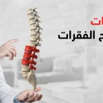 درجات تزحزح الفقرات
