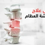 افضل علاج لهشاشة العظام