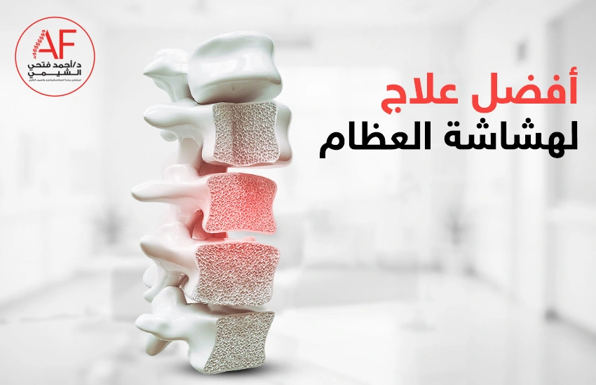 افضل علاج لهشاشة العظام يحميك من الكسور على المدى الطويل