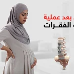 الحمل بعد عملية تثبيت الفقرات