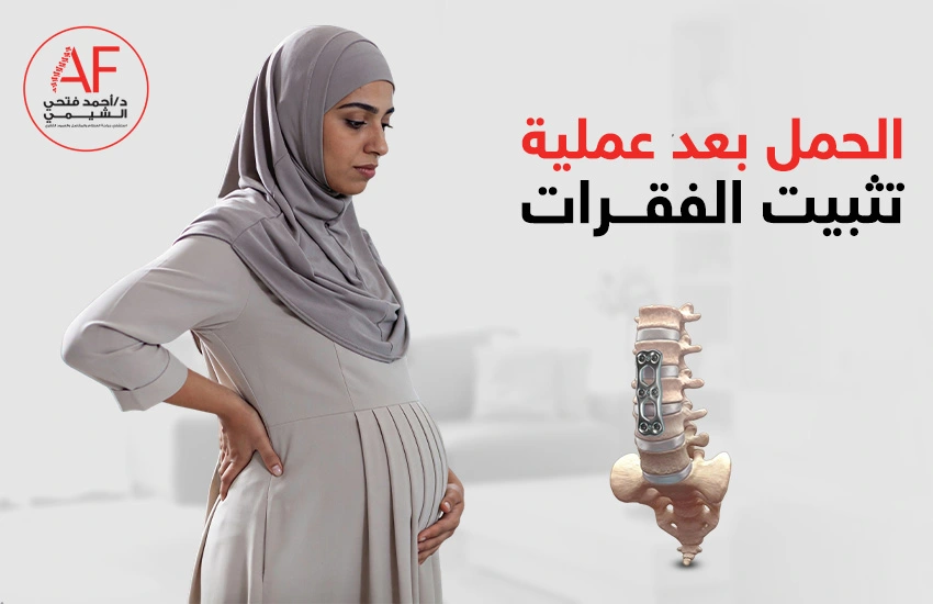 الحمل بعد عملية تثبيت الفقرات| هل هو آمن؟ ومتى يكون الوقت مناسبًا؟