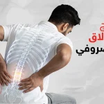 علاج الانزلاق الغضروفي