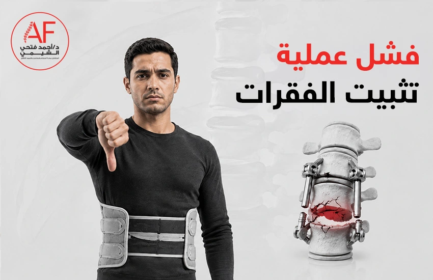 ما أسباب فشل عملية تثبيت الفقرات؟