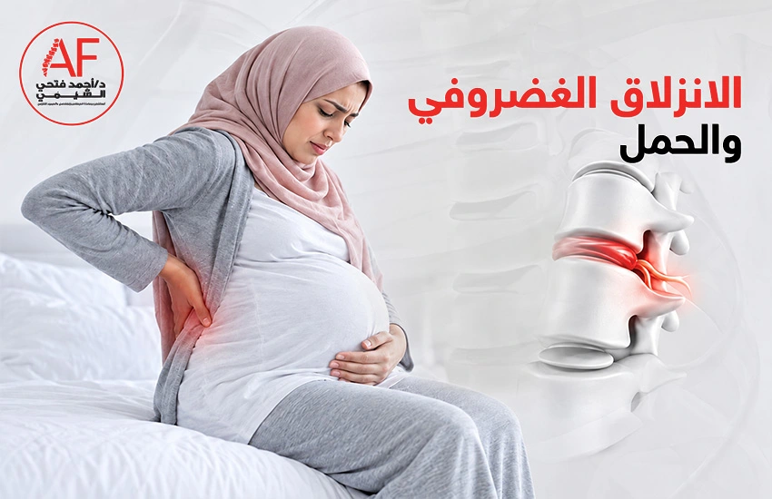 الانزلاق الغضروفي والحمل